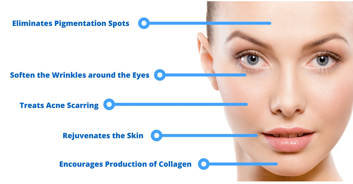 Side Effects of Micro Needling and Derma Roller Treatments