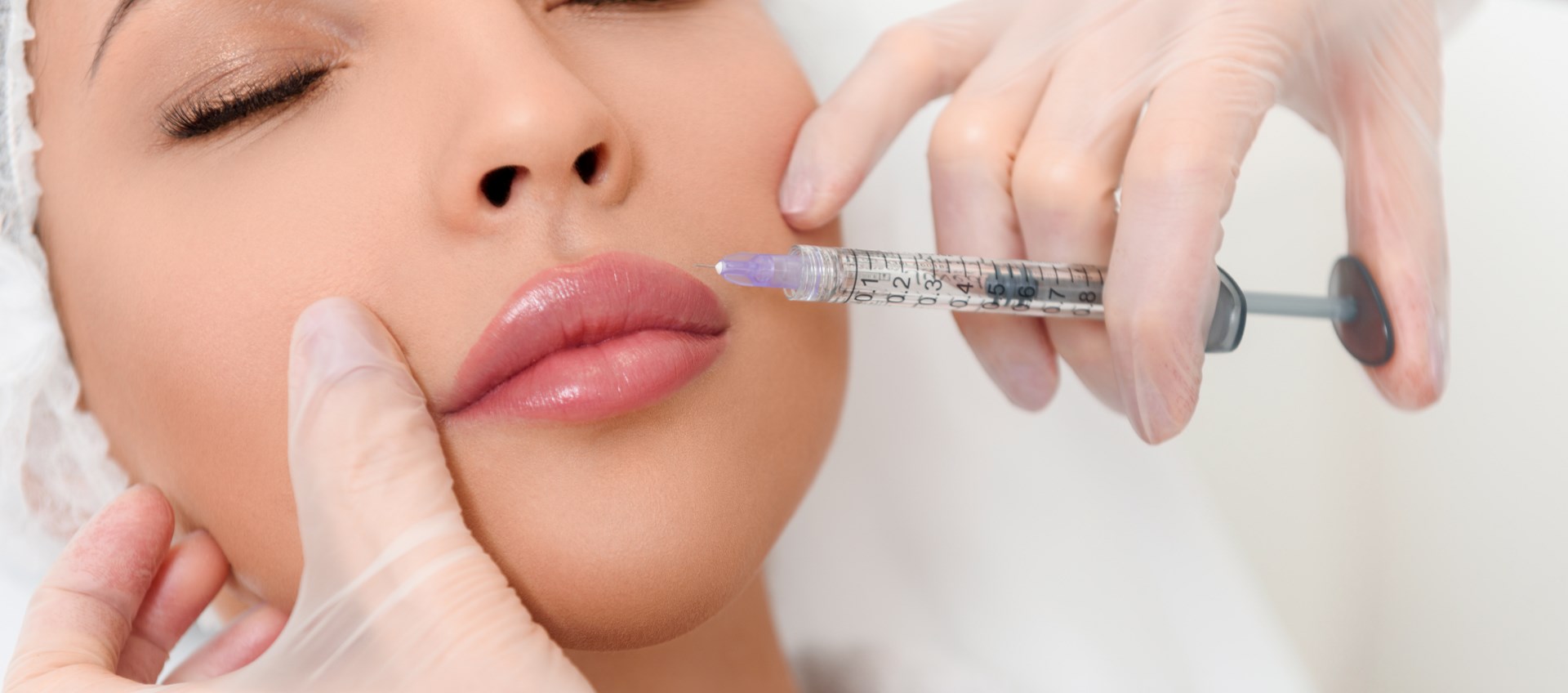 Dermal Fillers and Granulomas