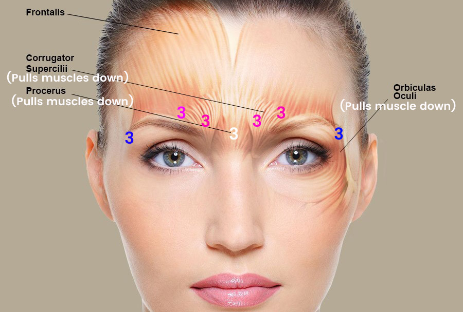 Dr. Ellis Botox and Asymmetrical Eyebrows