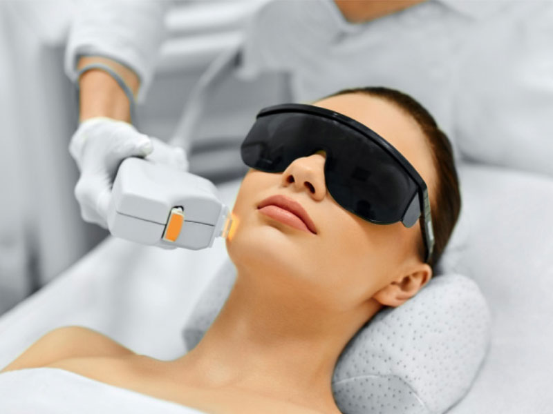 Photo Facial Recovery Time