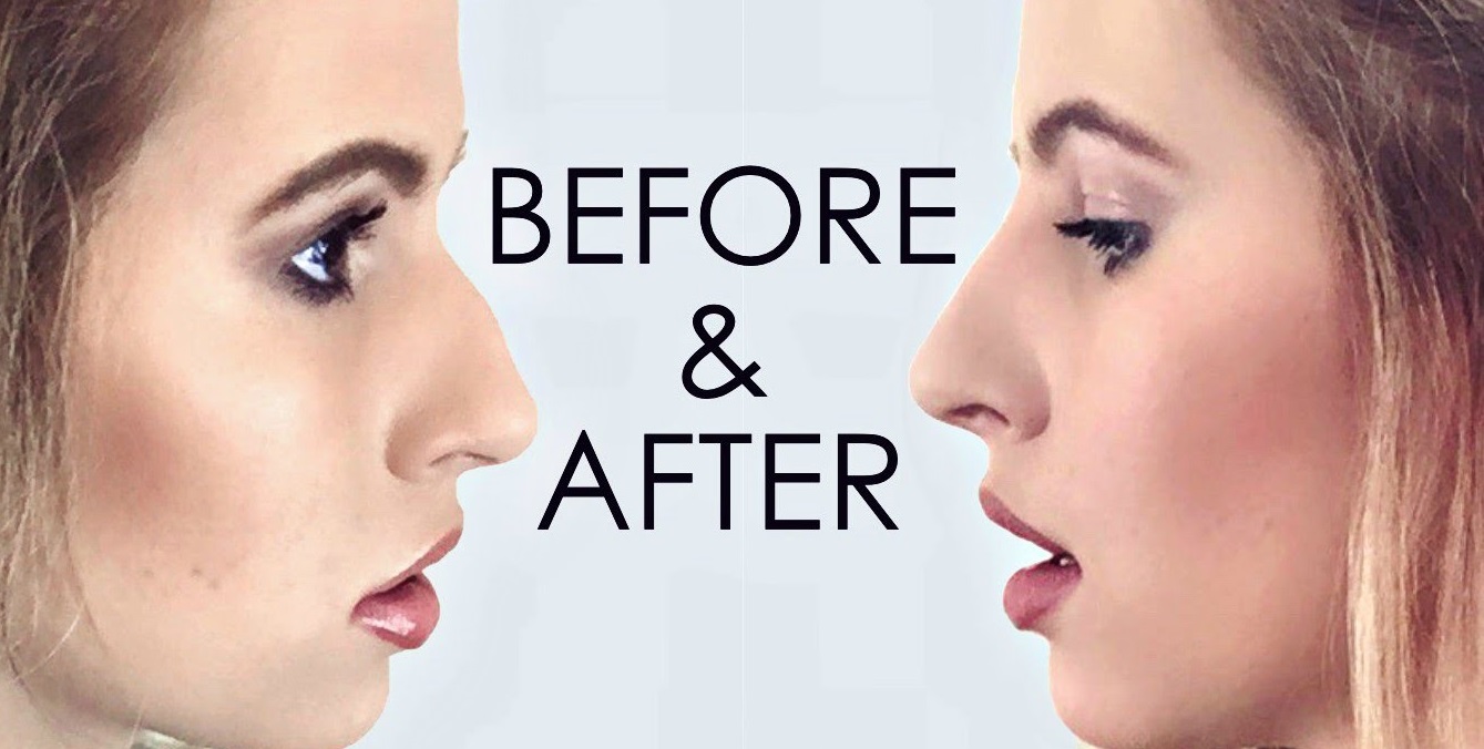 Microblading